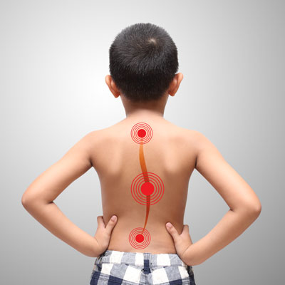 Scoliosis Chiropractor in Tampa FL - Conditions Chiropractic