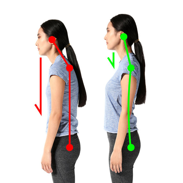 Posture Correction Chiropractor in Tampa FL